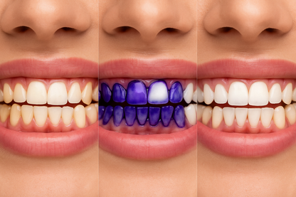 Hi Smile v34 - Teeth Whitening Paste