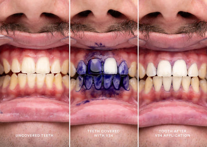 Hi Smile v34 - Teeth Whitening Paste